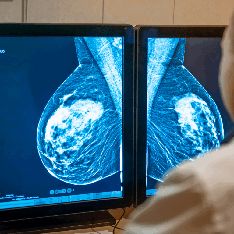 Estas son las pruebas para detectar el cáncer del seno