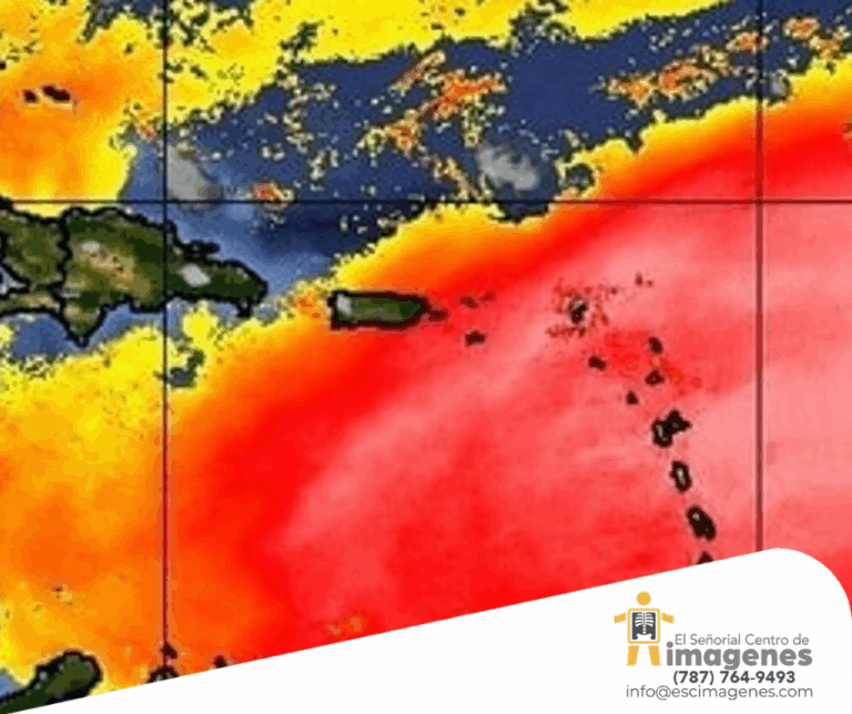 Los polvos del Sahara pueden agravar problemas respiratorios