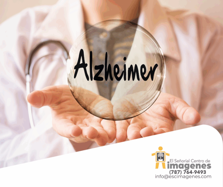 Día Mundial del Alzheimer
