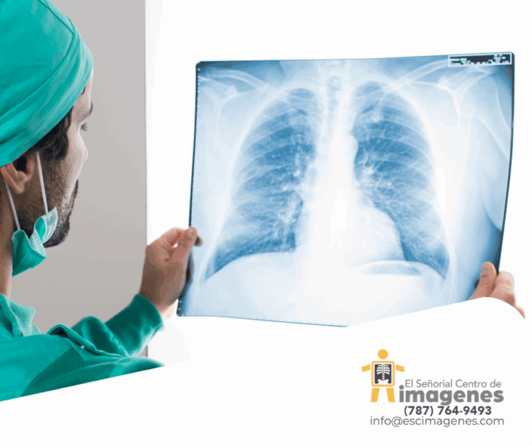 Importancia de la prueba para detectar cáncer de pulmón