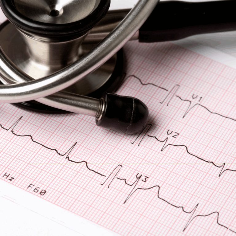 Pruebas para detectar las enfermedades del corazón