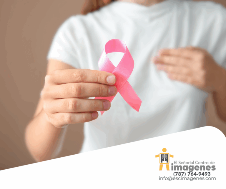 Cáncer de seno en mujeres jóvenes: El rol de las mamografías y las nuevas pautas de detección