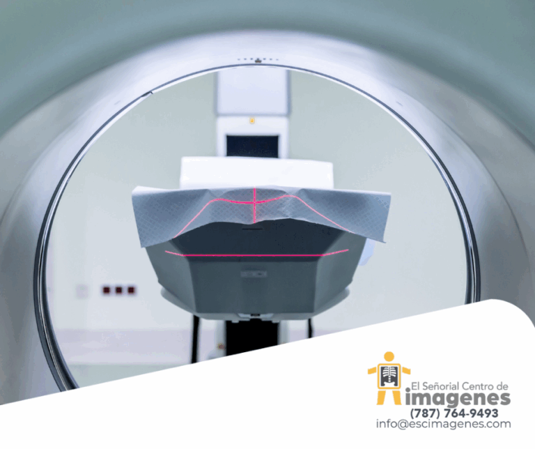 MRI: El estudio que puede salvar vidas detectando enfermedades a Tiempo