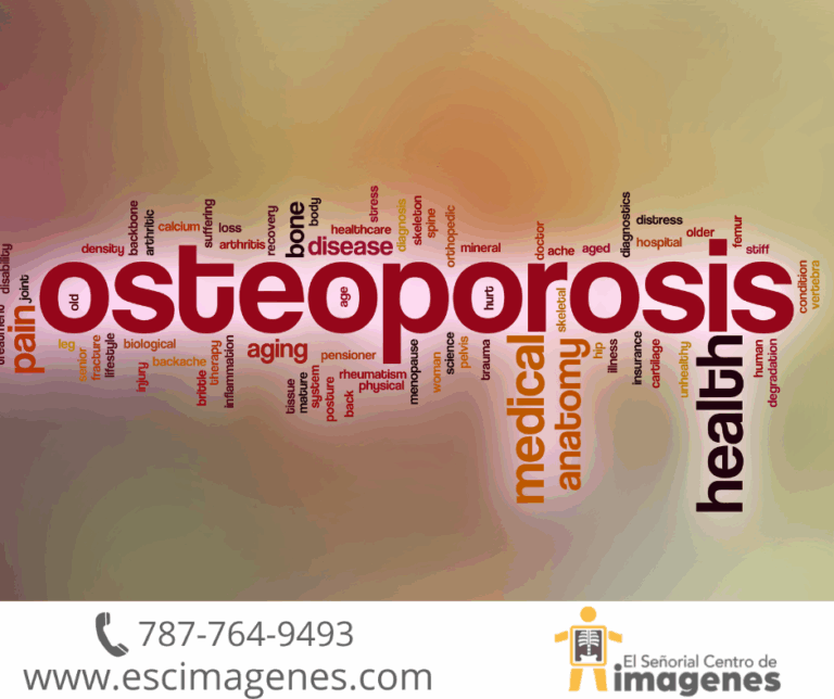 Mujeres mayores de 50 años tienen más riesgo de sufrir osteoporosis