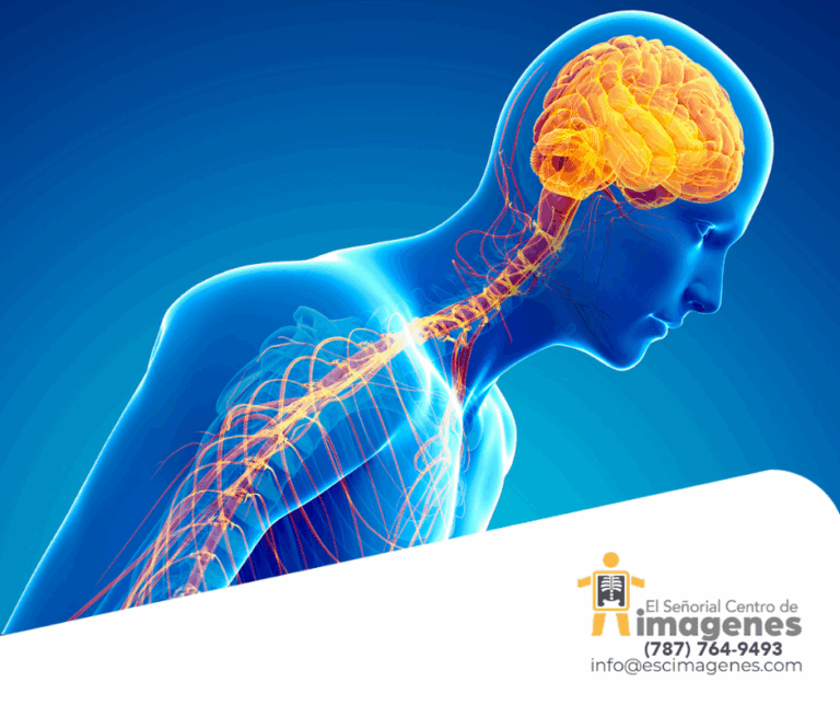 Relación entre el MRI y el Parkinson