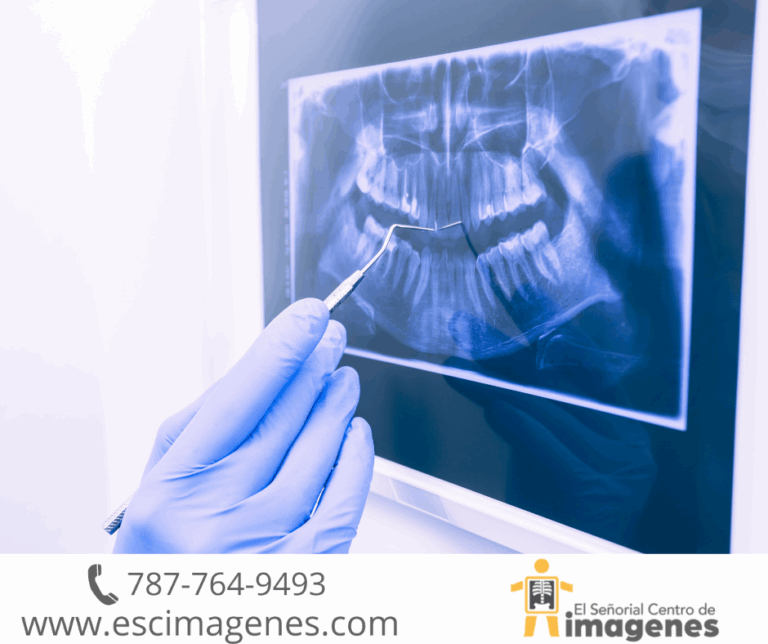 Uso de la radiología en el cuidado dental
