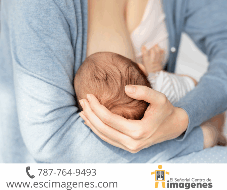 Semana Mundial de la Lactancia Materna: La relación entre la mamografía y la lactancia
