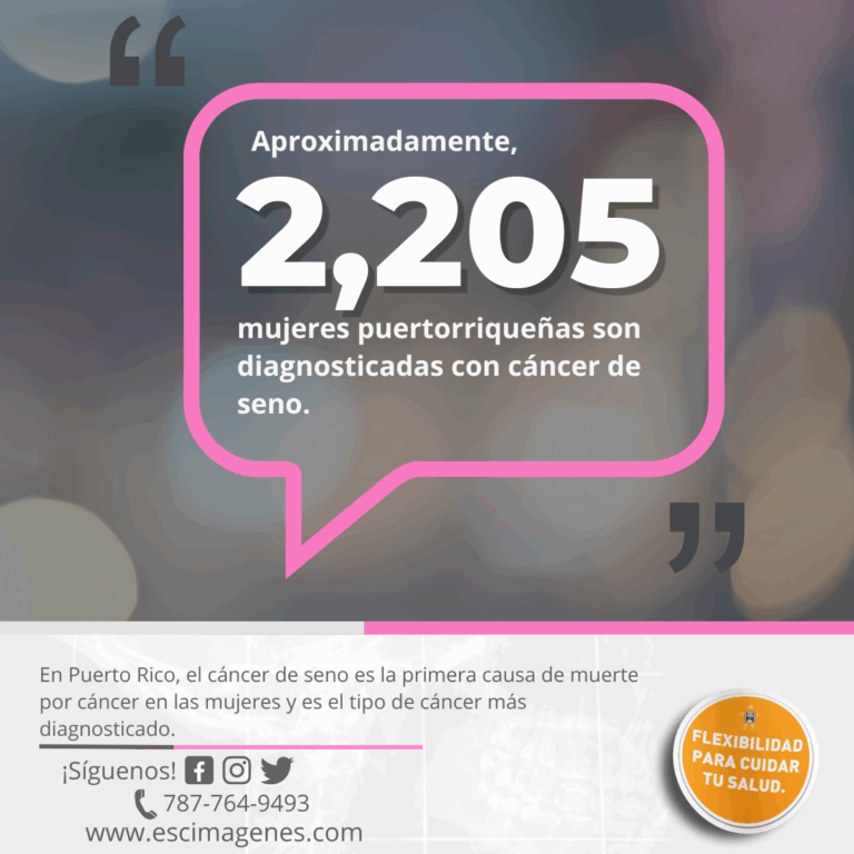 Estadísticas de cáncer de seno en Puerto Rico