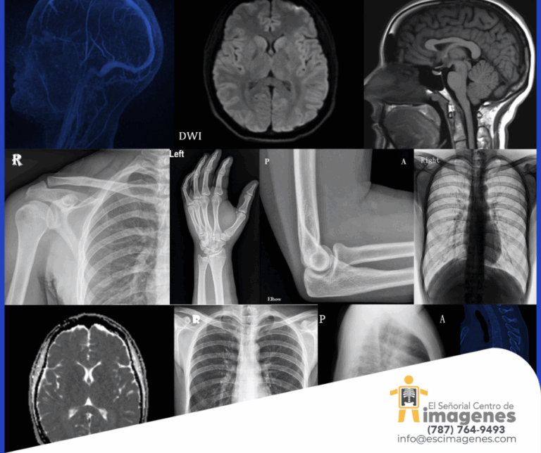Conoce la importancia de la radiología en la salud