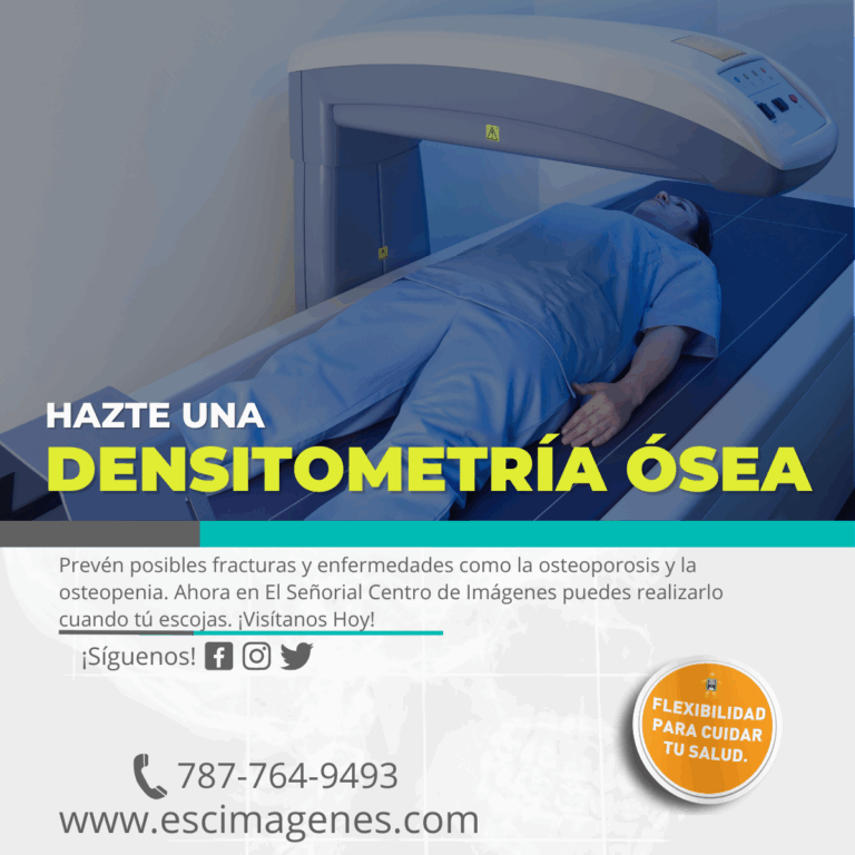 Este 2025 hazte la densitometría ósea