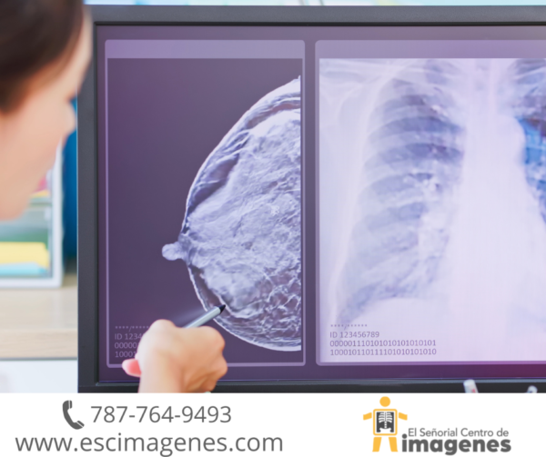 Detección temprana reduce mortalidad por cáncer de seno
