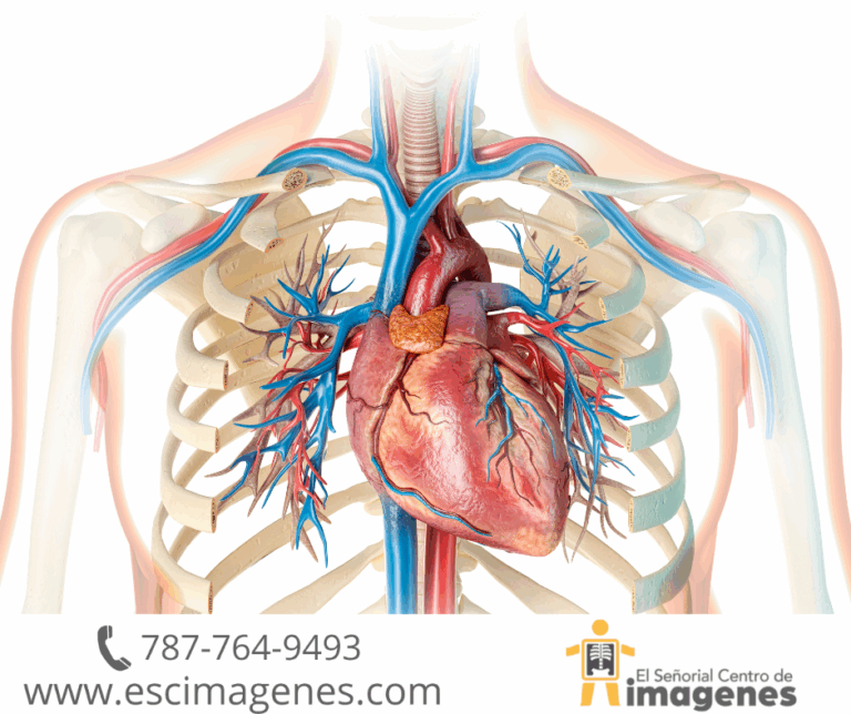 Clave la radiografía en la detección y tratamiento de enfermedades cardiovasculares