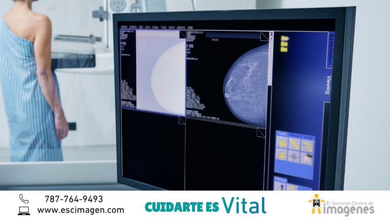La mamografía es VITAL para detectar el cáncer de seno a tiempo