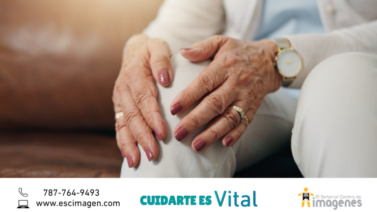 La osteoporosis avanza en silencio en Puerto Rico
